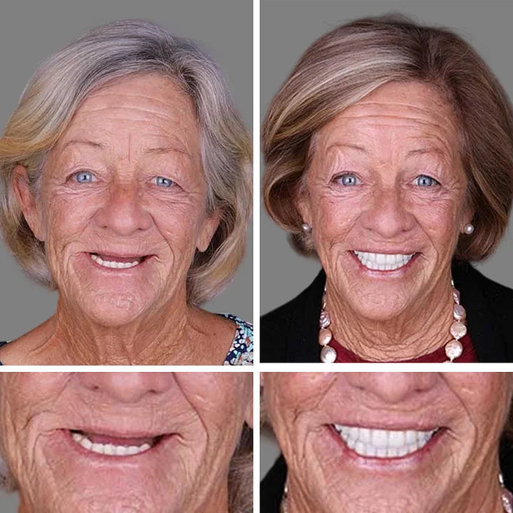 🔥Ends Today: 70% OFF! ⏰ 2026 Bestselling Product🦷 Fit for a Fresh Smile, Say Goodbye to Wearing Discomfort!